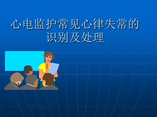 心电监护常见心律失常的识别及处理-医学课件