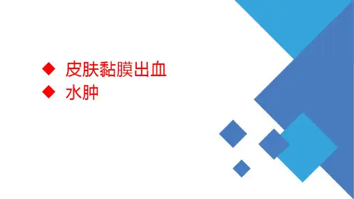 皮肤黏膜出血及水肿