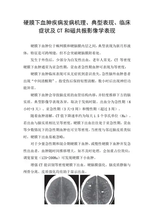 硬膜下血肿疾病发病机理、典型表现、临床症状及CT和磁共振影像学表现