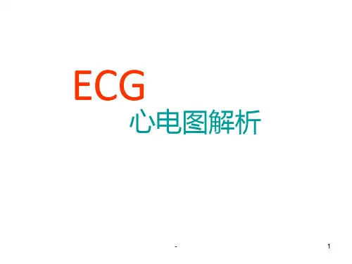 常见心律失常心电图解析PPT课件