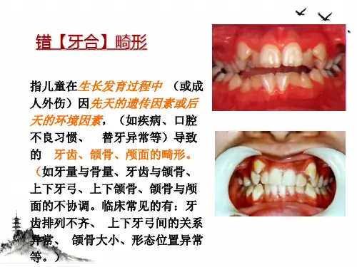 错颌畸形的病因PPT课件