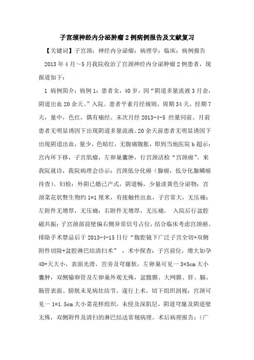 子宫颈神经内分泌肿瘤2例病例报告及文献复习