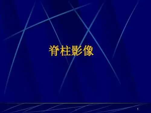 脊柱影像解剖PPT课件