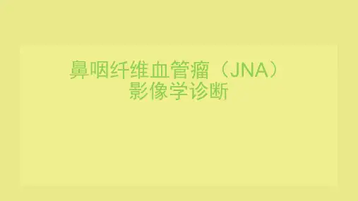 鼻咽纤维血管瘤的影像表现