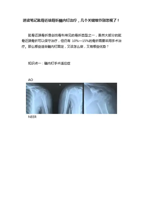 速读笔记肱骨近端骨折髓内钉治疗，几个关键细节别忽视了！