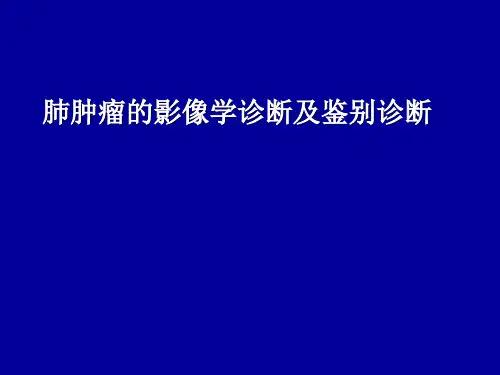 肺肿瘤的影像学诊断及鉴别诊断PPT课件