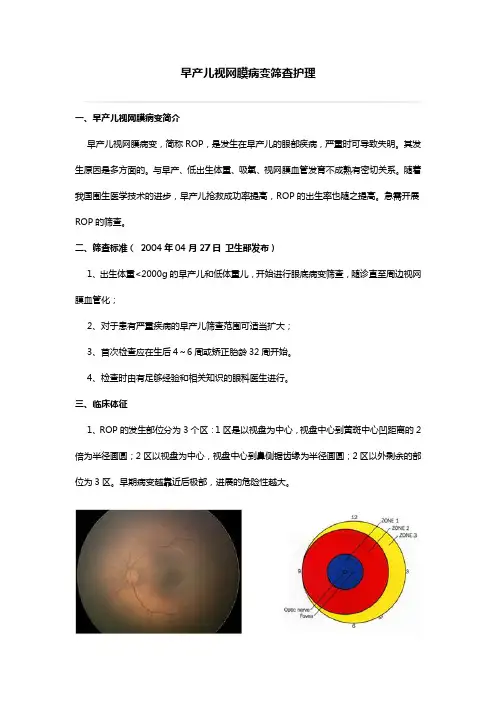 早产儿视网膜病变筛查护理