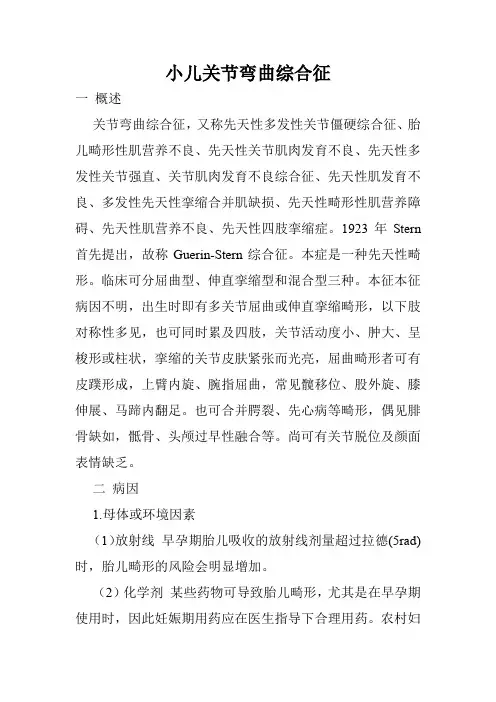 小儿关节弯曲综合征