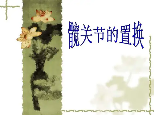 髋关节置换.ppt