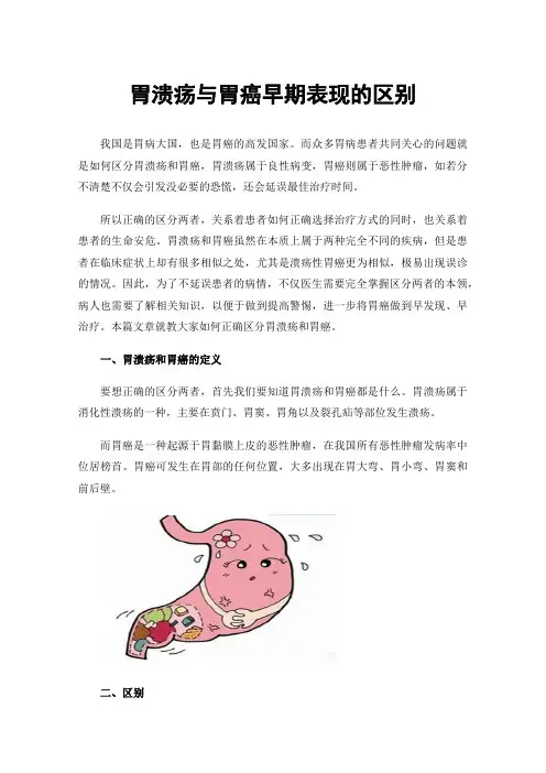 胃溃疡与胃癌早期表现的区别