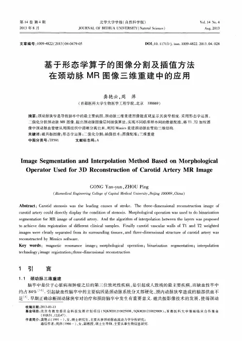基于形态学算子的图像分割及插值方法在颈动脉MR图像三维重建中的应用