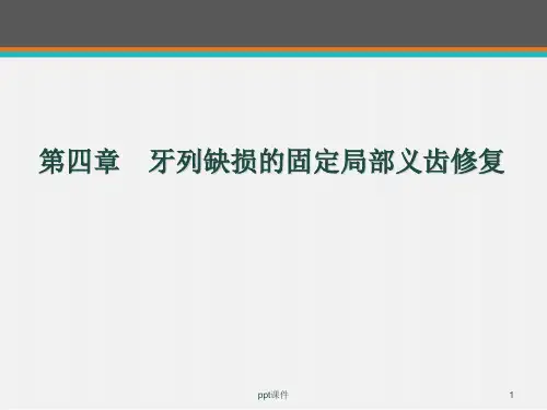 第四章 牙列缺损固定局部义齿修复  ppt课件