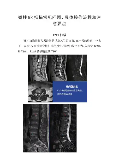 脊柱MR扫描常见问题、具体操作流程和注意要点