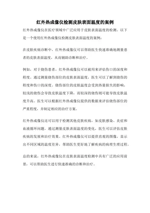 红外热成像仪检测皮肤表面温度的案例