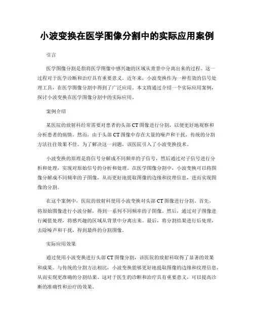 小波变换在医学图像分割中的实际应用案例