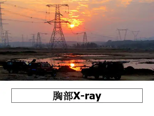 最新胸部X-ray教学讲义PPT课件
