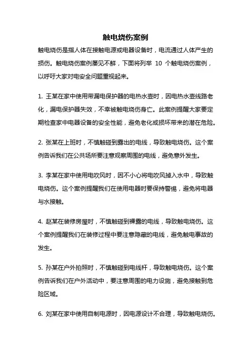 触电烧伤案例