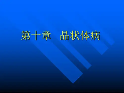 晶状体病