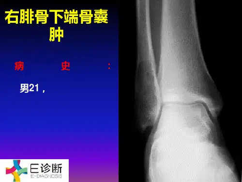 医学影像-骨肿瘤X线病例图谱(详细)ppt课件