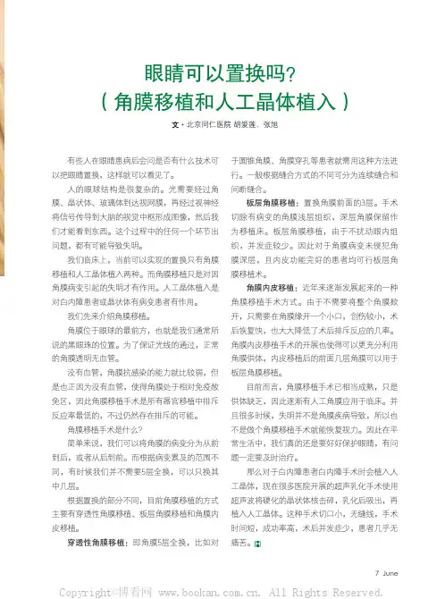 眼睛可以置换吗？（角膜移植和人工晶体植入）