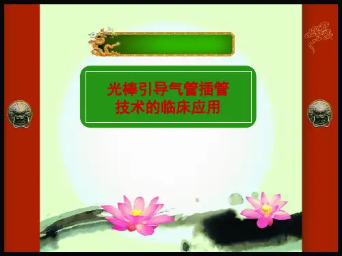 光棒引导气管插管技术的临床应用