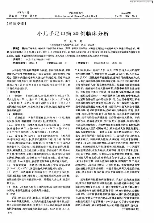 小儿手足口病20例临床分析