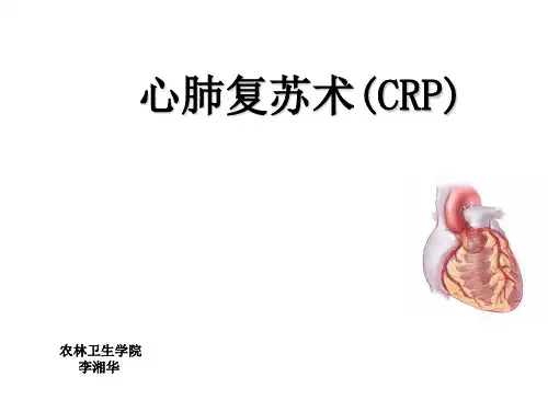 第十九章第二节：心肺复苏术