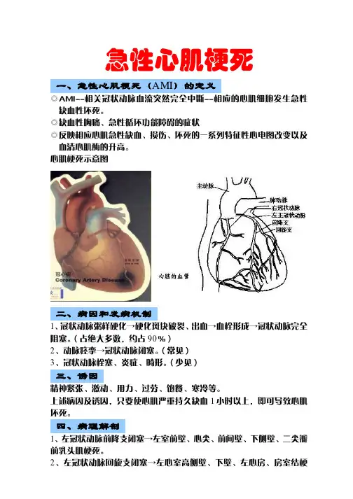 急性心肌梗死