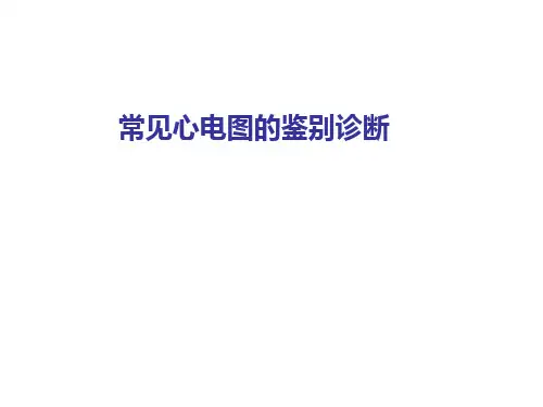 常见心电图鉴别诊断