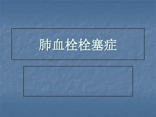 2019-肺栓塞诊治指南-文档资料