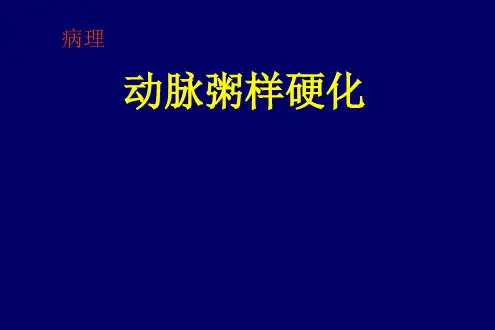 病理-动脉粥样硬化