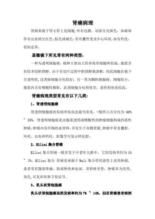 肾癌(病理)