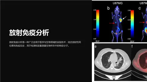 《放射免疫分析》课件