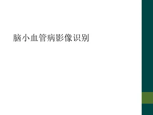 脑小血管病影像识别