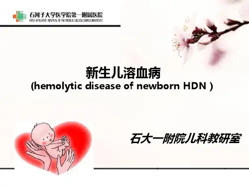 新生儿溶血病优秀PPT课件