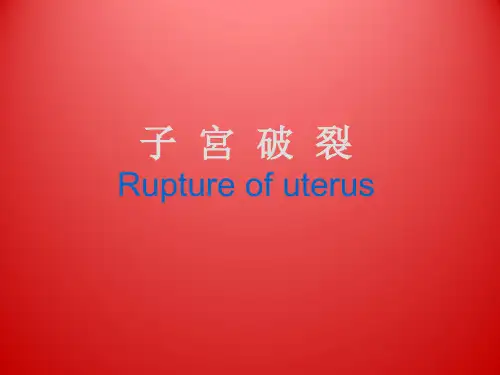 子宫破裂 PPT课件