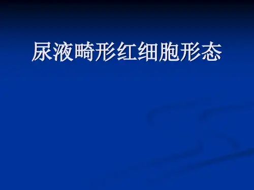 尿液畸形细胞形态鉴别