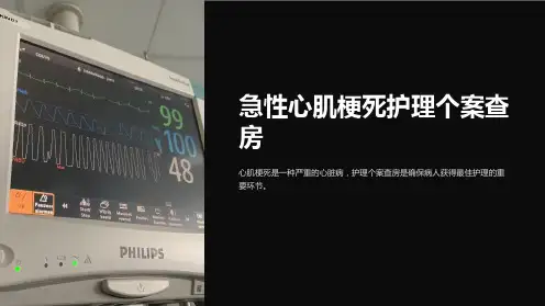 急性心肌梗死护理个案查房
