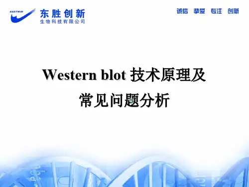 westernblot技术原理及常见问题分析