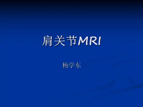 医学影像-肩关节MRI