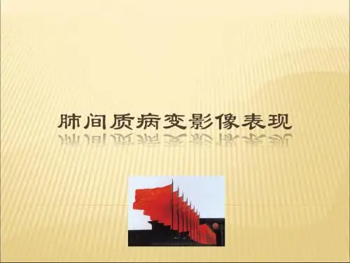 肺间质疾病影像表现