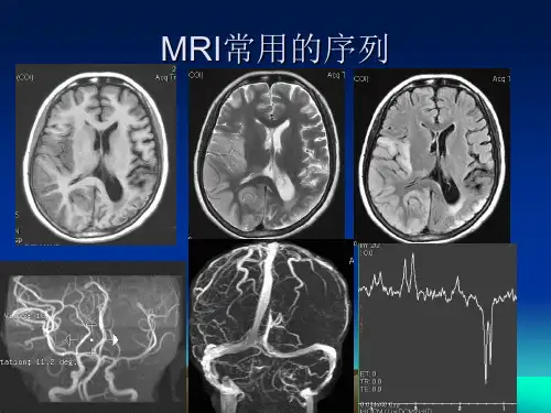 头颅MRI断层解剖02875