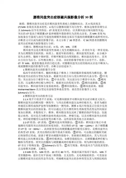 腰椎间盘突出症核磁共振影像分析30例