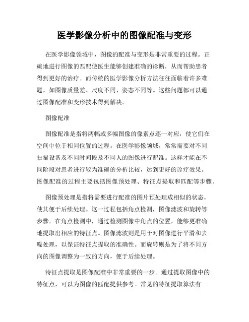 医学影像分析中的图像配准与变形