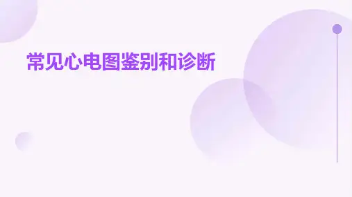 常见心电图鉴别和诊断