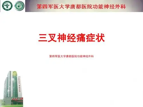 三叉神经痛症状