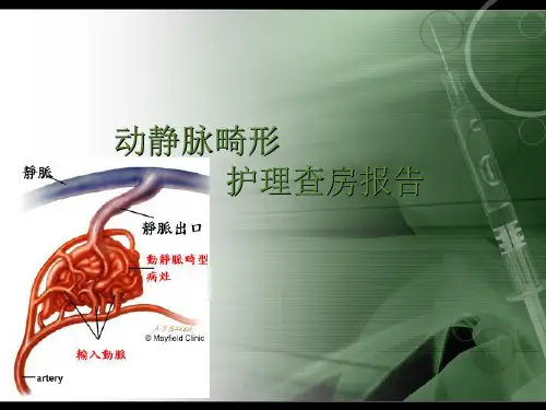 动静脉畸形ppt课件