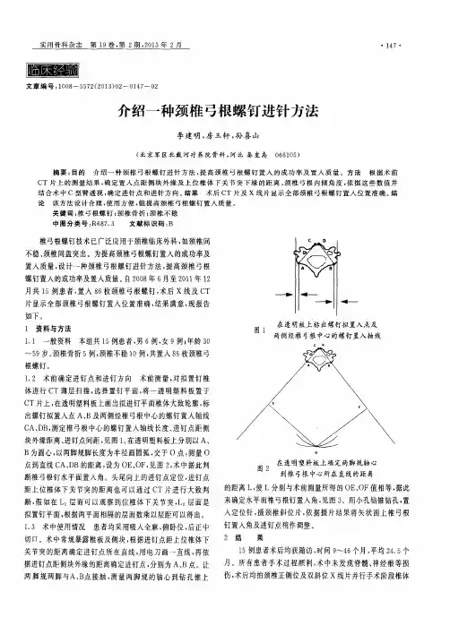 介绍一种颈椎弓根螺钉进针方法