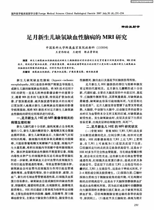 足月新生儿缺氧缺血性脑病的MRI研究