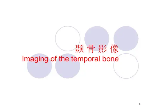 颞骨影像PPT课件
